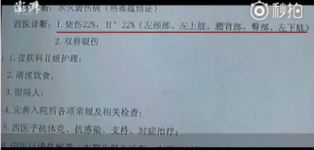 【ky.com】立夏要吃点营养的食材，把这两种工具，倒入锅中一起炖，实在鲜美(图1)