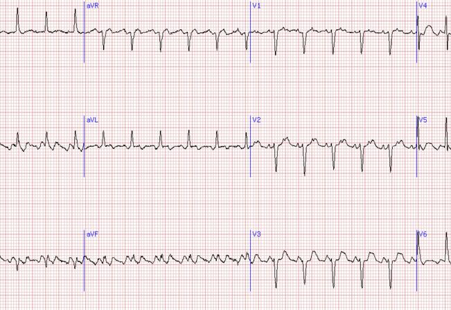 终结智能家居概念化海尔拿到首张物联网入场券-ky.com(图2)